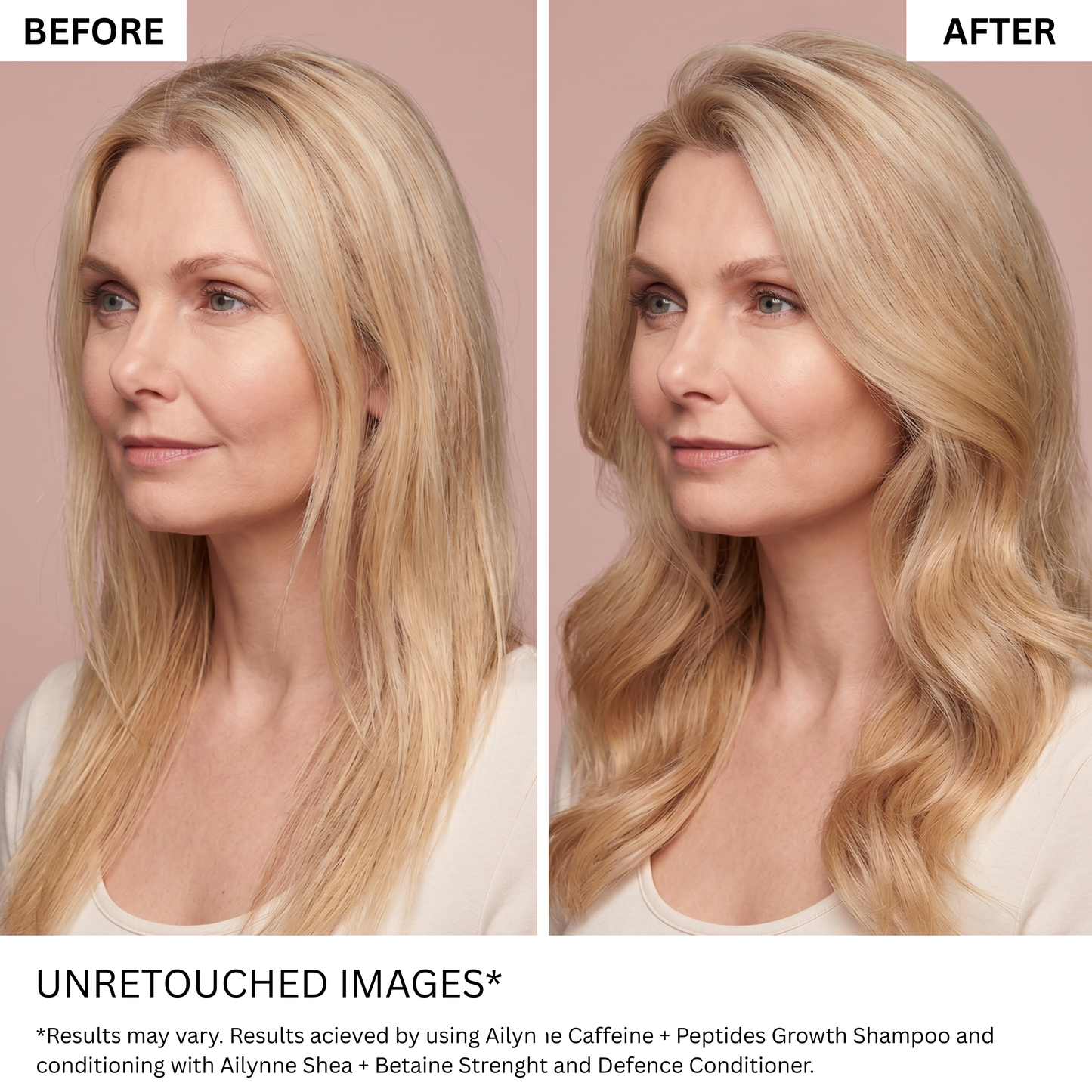 Complete Hair Transformation Bundle