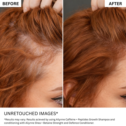 Hair Growth Bundle