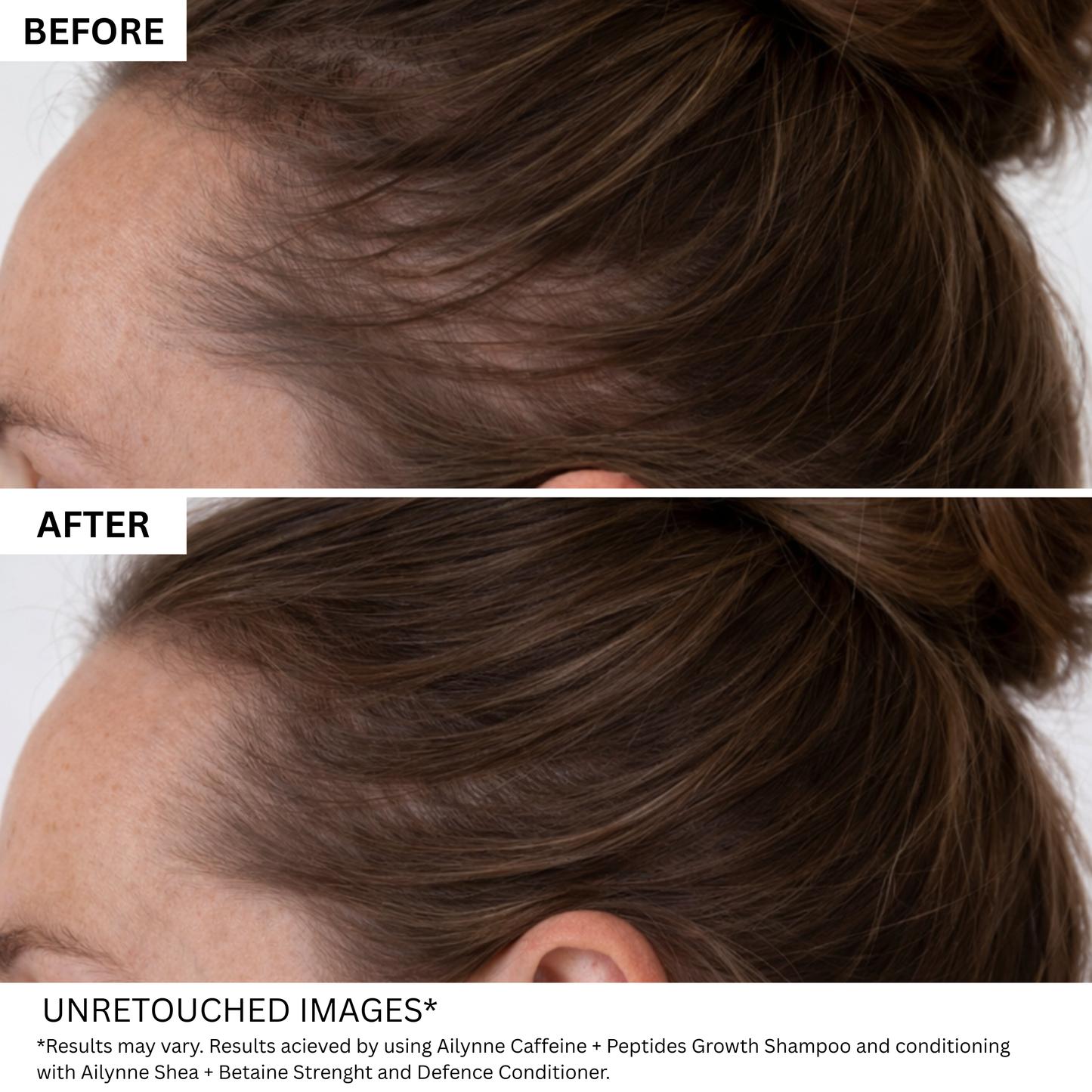 Hair Growth Bundle